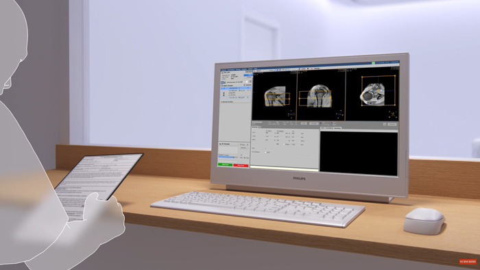 V&iacute;deo a mostrar o Philips SmartWorkflow em a&ccedil;&atilde;o