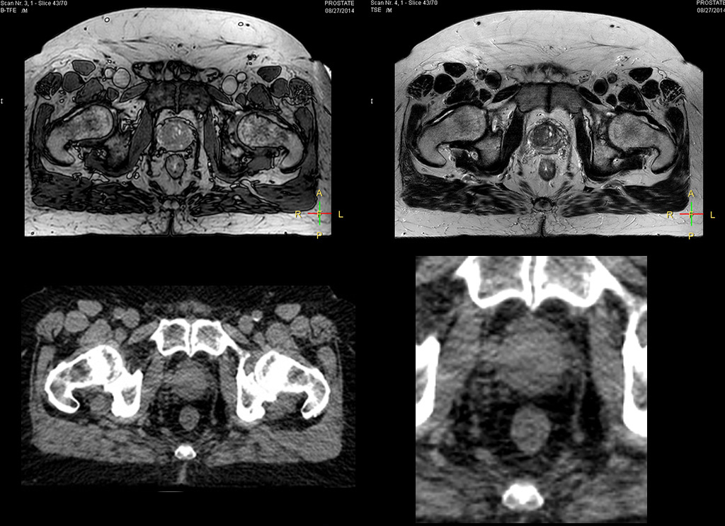 um close-up de uma varredura
