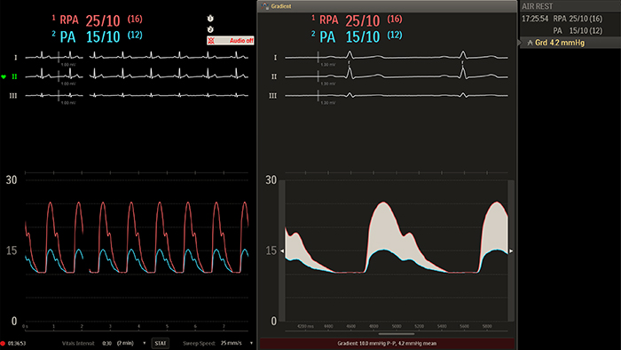 Miniatura da sala de exame