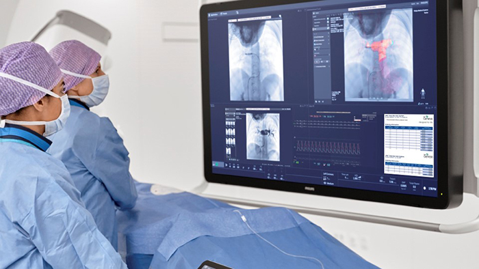 Intervenções de doença cardiovascular congénita