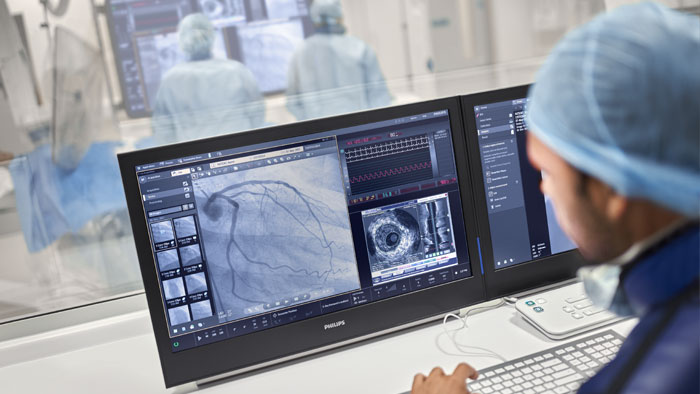 Intervenção coronária percutânea