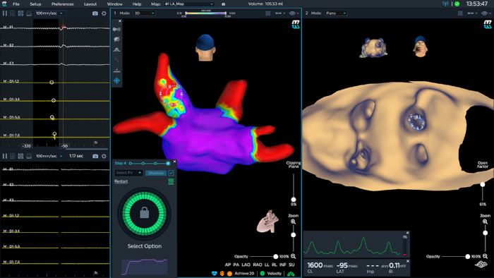 Imagiologia diel&eacute;trica