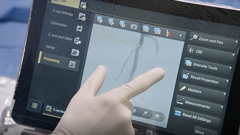 Apresentamos a nova gera&ccedil;&atilde;o do Philips Azurion para radiologia de interven&ccedil;&atilde;o