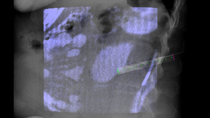 Orienta&ccedil;&atilde;o da trajet&oacute;ria em tempo real com XperGuide