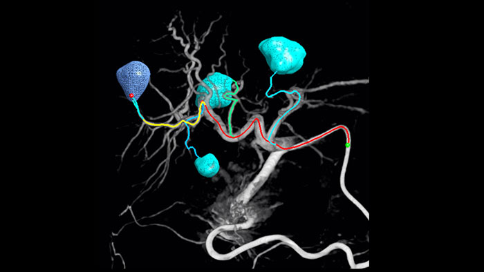 Navega&ccedil;&atilde;o de imagem do EmboGuide