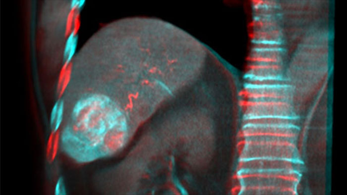 Fus&atilde;o de imagens com vista dupla