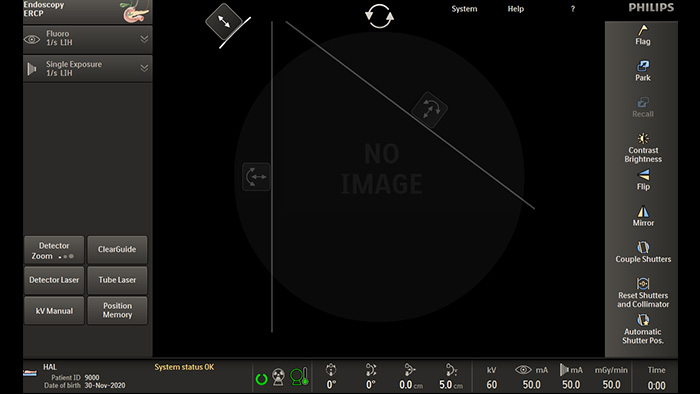 Colima&ccedil;&atilde;o assim&eacute;trica