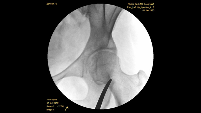 Melhoria autom&aacute;tica de imagens