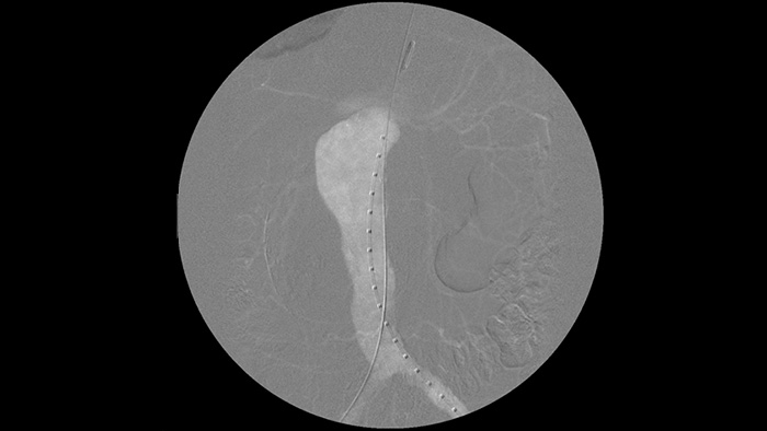 Op&ccedil;&otilde;es de contraste de iodo e CO2