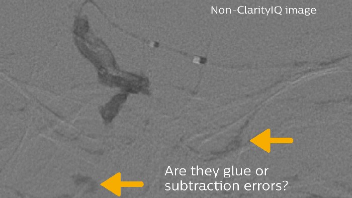 erro de subtra&ccedil;&atilde;o e cola