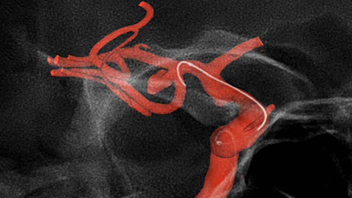 Visualiza&ccedil;&atilde;o melhorada do SmartCT Roadmap