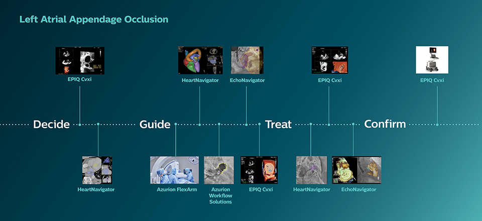 Oclus&atilde;o do ap&ecirc;ndice atrial esquerdo