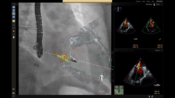 Fus&atilde;o MClip Xplane
