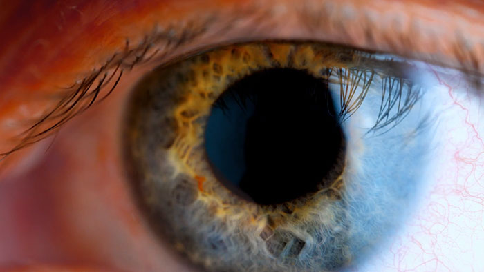 Sistema de ultrassons de interven&ccedil;&atilde;o do EPIQ CVxi