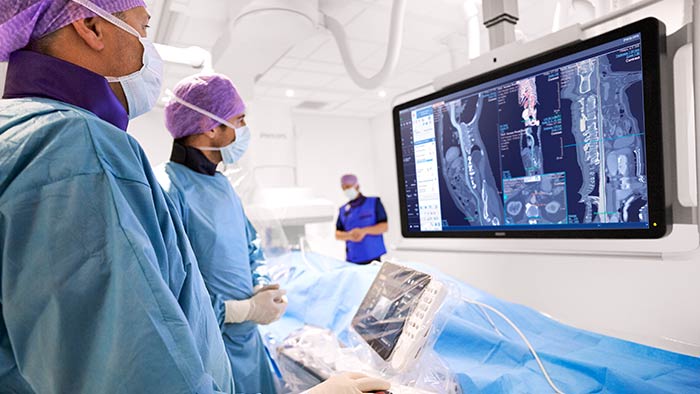 Solu&ccedil;&otilde;es de fluxo de trabalho Azurion