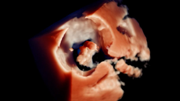 Visualiza&ccedil;&atilde;o TrueVue