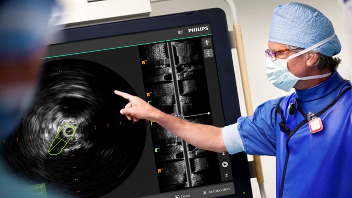 Procedimentos venosos