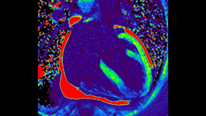 Mapa p&oacute;s-gado T1