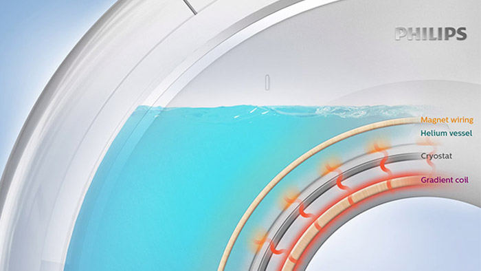 Confian&ccedil;a cl&iacute;nica na RM card&iacute;aca