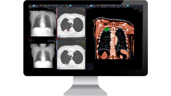 Ecr&atilde; da interface do m&oacute;dulo de diagn&oacute;stico de radiologia num monitor