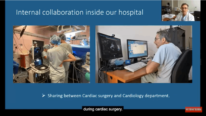 Acesso do Collaboration Live ao v&iacute;deo da sua equipa
