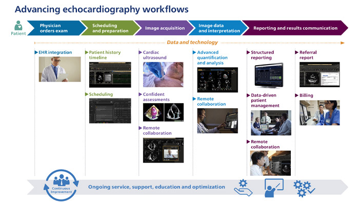 Avan&ccedil;os dos fluxos de trabalho de ecocardiografia