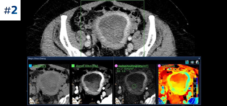 Abd&oacute;men e p&eacute;lvis