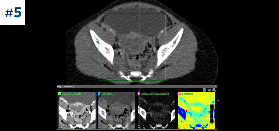 Abd&oacute;men pedi&aacute;trico