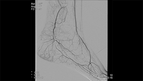 um grande plano de uma radiografia de um p&eacute; humano