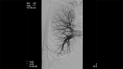 um grande plano de uma radiografia de um corpo humano