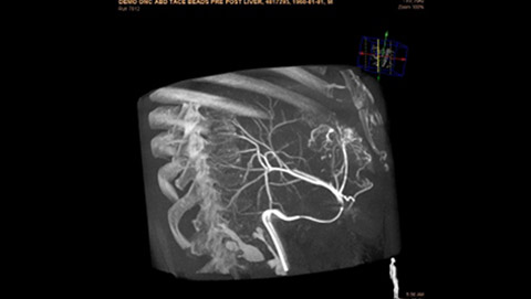 uma radiografia de um t&oacute;rax humano