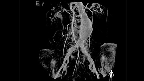 um grande plano do corpo de um homem