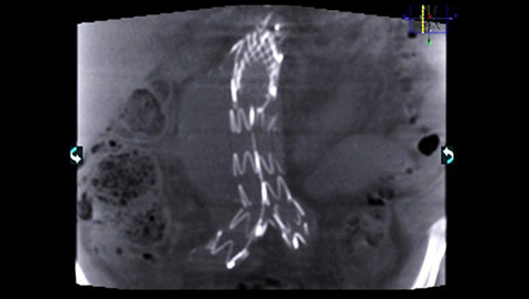 um grande plano de um raio-x