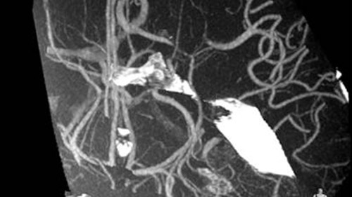 um grande plano de uma radiografia de um corpo humano