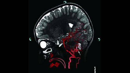 um grande plano de uma tomografia cerebral