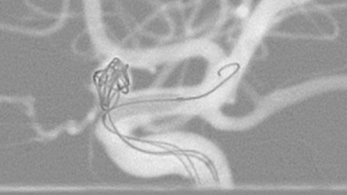 um grande plano de um exame m&eacute;dico