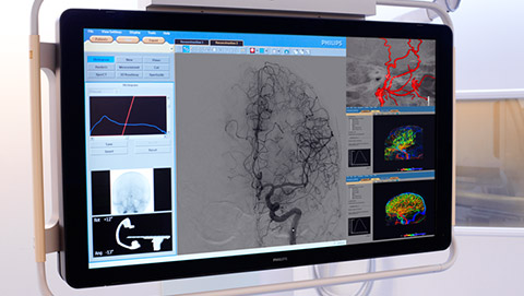 um ecr&atilde; de computador mostrando uma tomografia cerebral