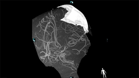 um grande plano de uma tomografia cerebral