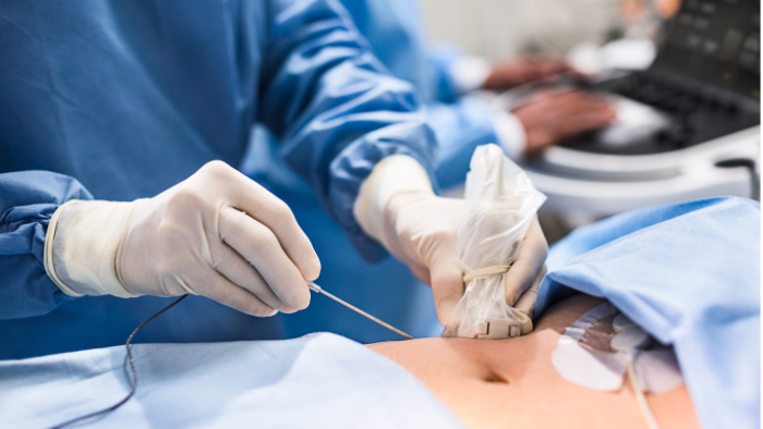 Imagem em miniatura da radiologia de interven&ccedil;&atilde;o