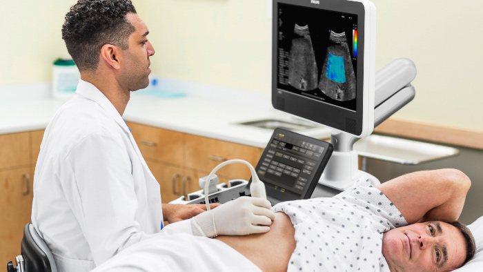 Imagem em miniatura do f&iacute;gado