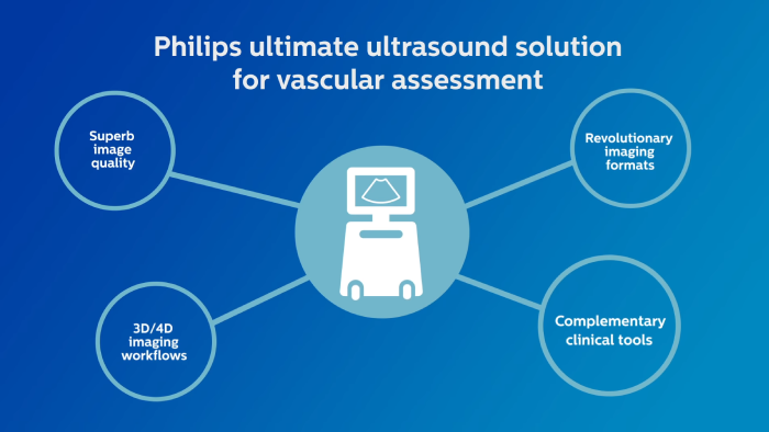 V&iacute;deo que explica a melhor solu&ccedil;&atilde;o de ultrassons da Philips para a avalia&ccedil;&atilde;o vascular