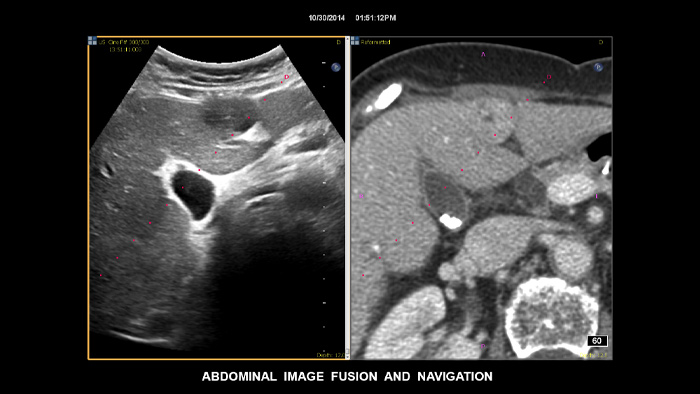 Fus&atilde;o de imagens com navega&ccedil;&atilde;o
