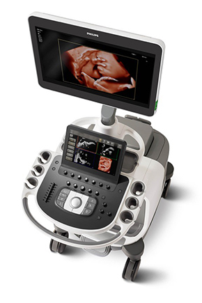 M&aacute;quina de ultrassom Epiq 7 para obstetr&iacute;cia e ginecologia