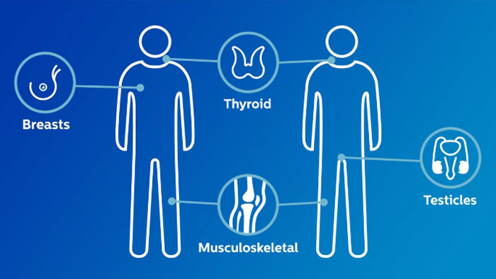 V&iacute;deo que explica o melhor ec&oacute;grafo para partes moles da Philips