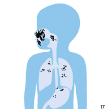 M&aacute;scara com m&aacute; veda&ccedil;&atilde;o