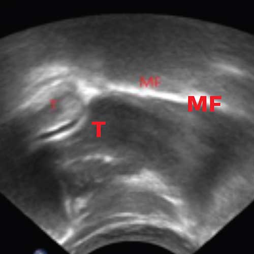 Biomec&acirc;nica, alimenta&ccedil;&atilde;o infantil, com base cient&iacute;fica para parteiras, profissionais de cuidados de sa&uacute;de