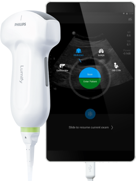 Aplica&ccedil;&atilde;o Lumify para Android and iPhone 